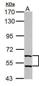 TrxR1 Antibody in Western Blot (WB)