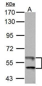 TrxR1 Antibody in Western Blot (WB)