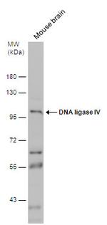 DNA ligase IV Antibody in Western Blot (WB)