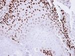 p73 Antibody in Immunohistochemistry (Paraffin) (IHC (P))