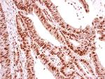 p73 Antibody in Immunohistochemistry (Paraffin) (IHC (P))