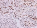 p73 Antibody in Immunohistochemistry (Paraffin) (IHC (P))