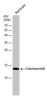 Calcineurin B Antibody in Western Blot (WB)