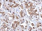 Bcl-10 Antibody in Immunohistochemistry (Paraffin) (IHC (P))