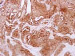 NPC2 Antibody in Immunohistochemistry (Paraffin) (IHC (P))