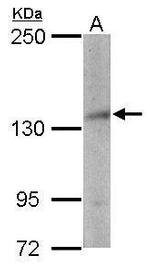 NSD3 Antibody in Western Blot (WB)