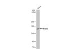 NSD3 Antibody in Western Blot (WB)