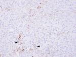 CCR6 Antibody in Immunohistochemistry (Paraffin) (IHC (P))