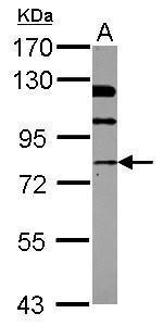 NSF Antibody in Western Blot (WB)