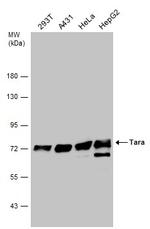 Tara Antibody in Western Blot (WB)