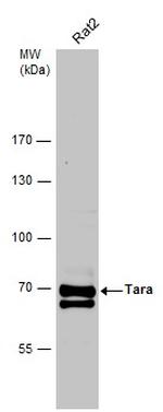 Tara Antibody in Western Blot (WB)