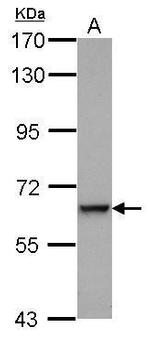 Complement C9 Antibody in Western Blot (WB)
