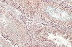 SETDB1 Antibody in Immunohistochemistry (Paraffin) (IHC (P))