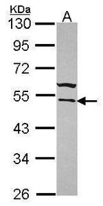 WARS Antibody in Western Blot (WB)