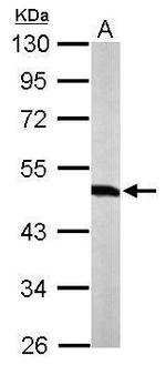 WARS Antibody in Western Blot (WB)