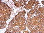 Cytokeratin 6 Antibody in Immunohistochemistry (Paraffin) (IHC (P))