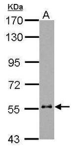 Cytokeratin 6 Antibody in Western Blot (WB)