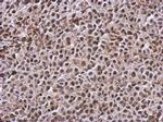 TIGAR Antibody in Immunohistochemistry (Paraffin) (IHC (P))