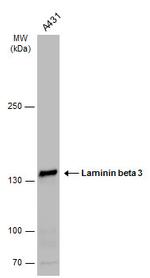 Laminin beta-3 Antibody in Western Blot (WB)