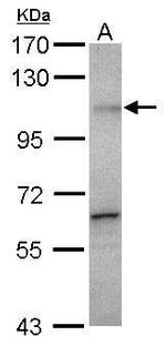 Gemin 3 Antibody in Western Blot (WB)