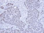 PPIL2 Antibody in Immunohistochemistry (Paraffin) (IHC (P))