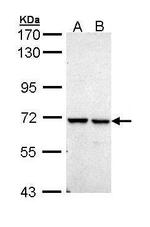 PPIL2 Antibody in Western Blot (WB)