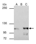 alpha Catenin Antibody in Immunoprecipitation (IP)