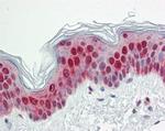 SPC25 Antibody in Immunohistochemistry (Paraffin) (IHC (P))