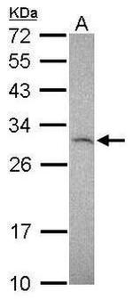 TIMP1 Antibody in Western Blot (WB)