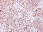 ELP4 Antibody in Immunohistochemistry (Paraffin) (IHC (P))