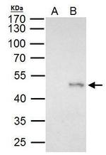 ELP4 Antibody in Immunoprecipitation (IP)