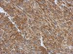 RPS3A Antibody in Immunohistochemistry (Paraffin) (IHC (P))