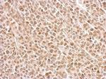 Securin Antibody in Immunohistochemistry (Paraffin) (IHC (P))