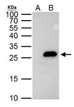 Securin Antibody in Immunoprecipitation (IP)