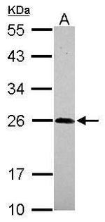 NGF Antibody in Western Blot (WB)