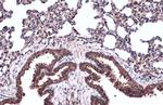 TUBA1A Antibody in Immunohistochemistry (Paraffin) (IHC (P))