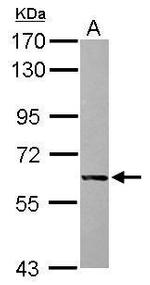 Intestinal Alkaline Phosphatase Antibody in Western Blot (WB)