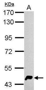 HERPUD1 Antibody in Western Blot (WB)