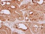 HSPA4 Antibody in Immunohistochemistry (Paraffin) (IHC (P))