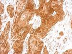 AMFR Antibody in Immunohistochemistry (Paraffin) (IHC (P))