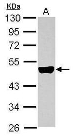 Cytokeratin 33B Antibody in Western Blot (WB)