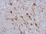 KTN1 Antibody in Immunohistochemistry (Paraffin) (IHC (P))