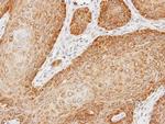 KTN1 Antibody in Immunohistochemistry (Paraffin) (IHC (P))