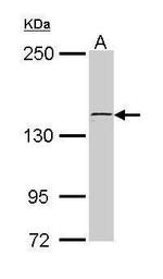 KTN1 Antibody in Western Blot (WB)