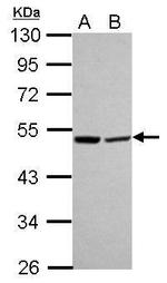 LACTB Antibody in Western Blot (WB)