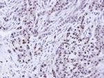 BAG1 Antibody in Immunohistochemistry (Paraffin) (IHC (P))