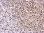 PI3K p85 alpha Antibody in Immunohistochemistry (Paraffin) (IHC (P))