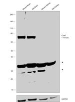 ChAT Antibody in Western Blot (WB)