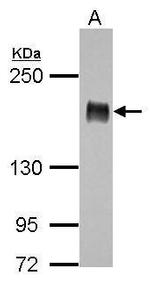 IRS1 Antibody in Western Blot (WB)