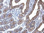 Cytokeratin 5 Antibody in Immunohistochemistry (Paraffin) (IHC (P))